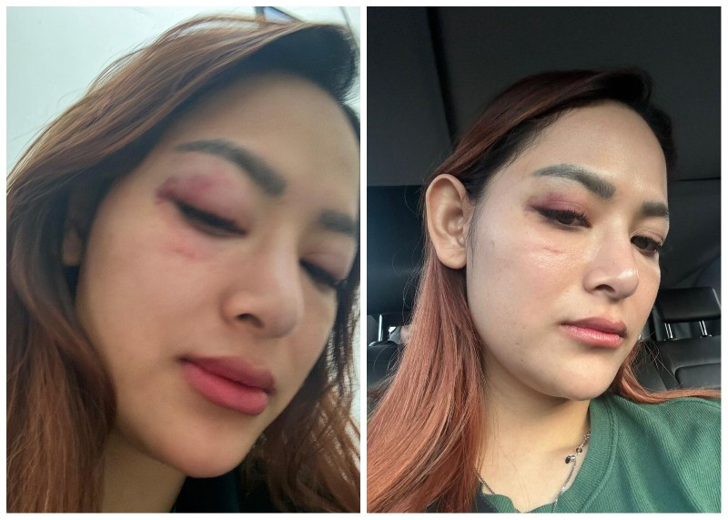 Korban KDRT di Pekanbaru Berharap Terlapor Ditangkap